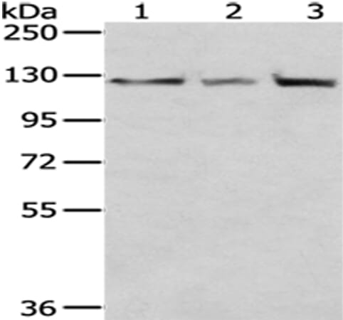 Gel: 6%SDS-PAGE Lysate: 40 &#956;g Lane 1-3: Hela, 293T and hepg2 cell Primary antibody: 1/400 dilution Secondary antibody: Goat anti rabbit IgG at 1/8000 dilution Exposure time: 5 seconds