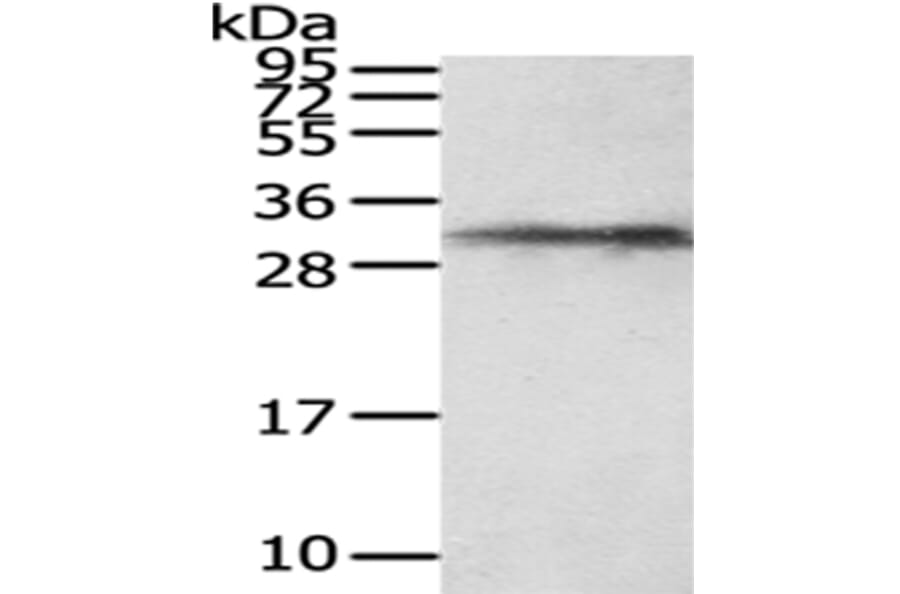 HUS1 Antibody from Signalway Antibody (43027) - Antibodies.com