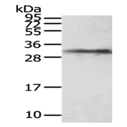 HUS1 Antibody from Signalway Antibody (43027) - Antibodies.com