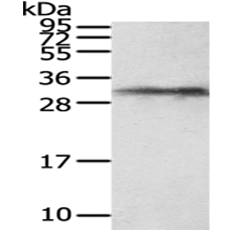 HUS1 Antibody from Signalway Antibody (43027) - Antibodies.com