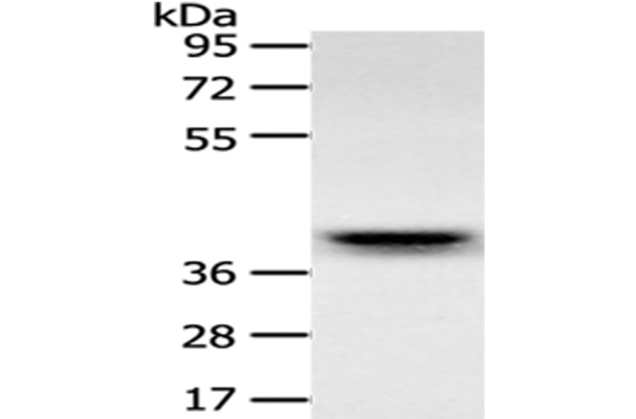 RFC2 Antibody from Signalway Antibody (43122) - Antibodies.com
