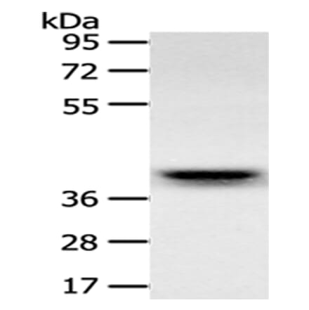 RFC2 Antibody from Signalway Antibody (43122) - Antibodies.com