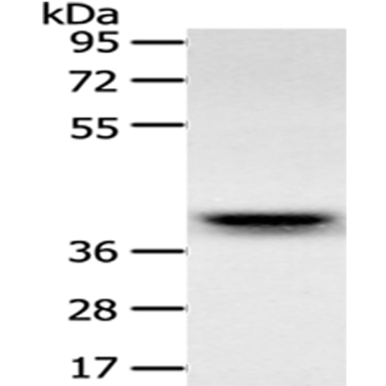 RFC2 Antibody from Signalway Antibody (43122) - Antibodies.com