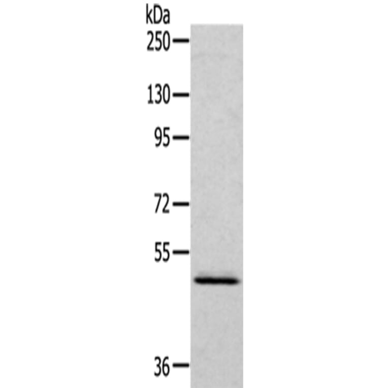 RCC1 Antibody from Signalway Antibody (43140) - Antibodies.com