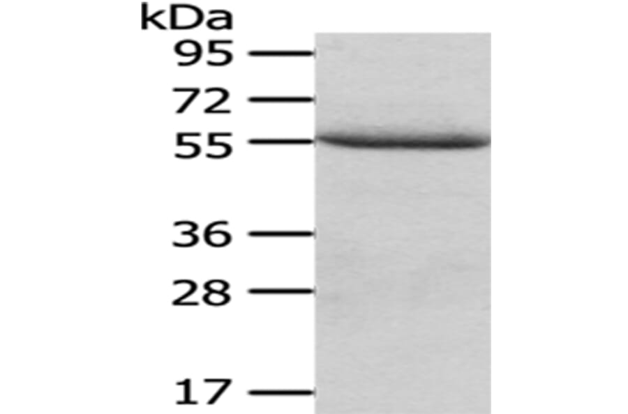 XIAP Antibody from Signalway Antibody (43189) - Antibodies.com
