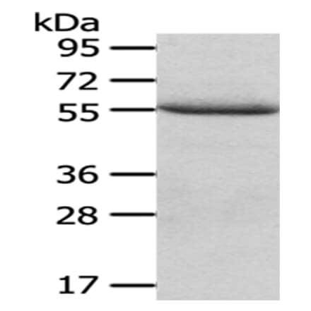 XIAP Antibody from Signalway Antibody (43189) - Antibodies.com