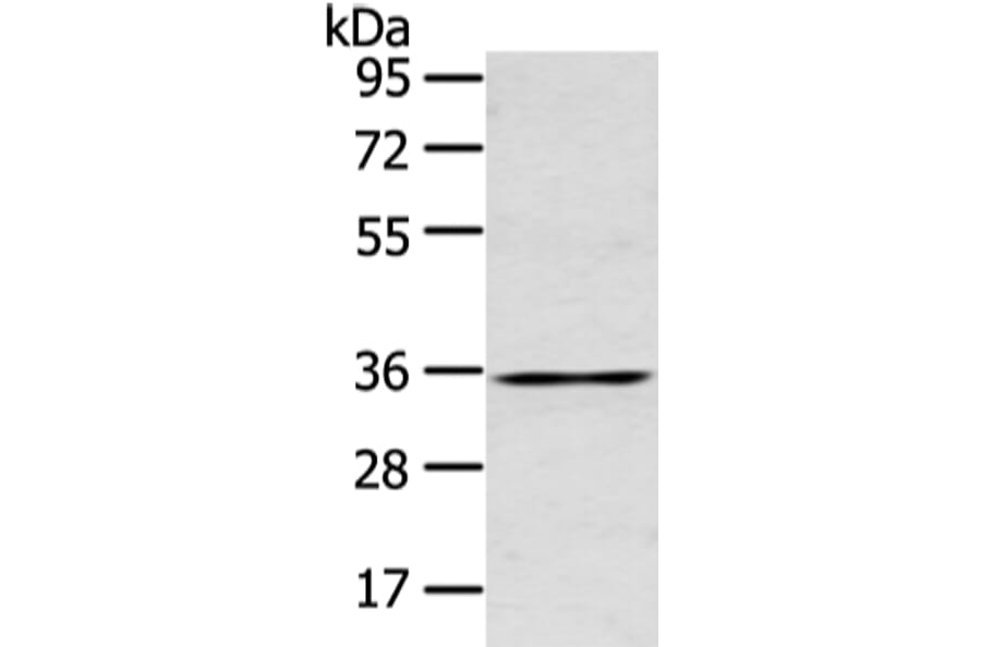 GJB5 Antibody from Signalway Antibody (43239) - Antibodies.com