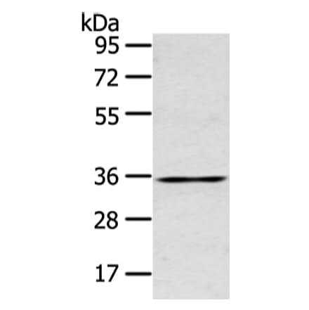 GJB5 Antibody from Signalway Antibody (43239) - Antibodies.com