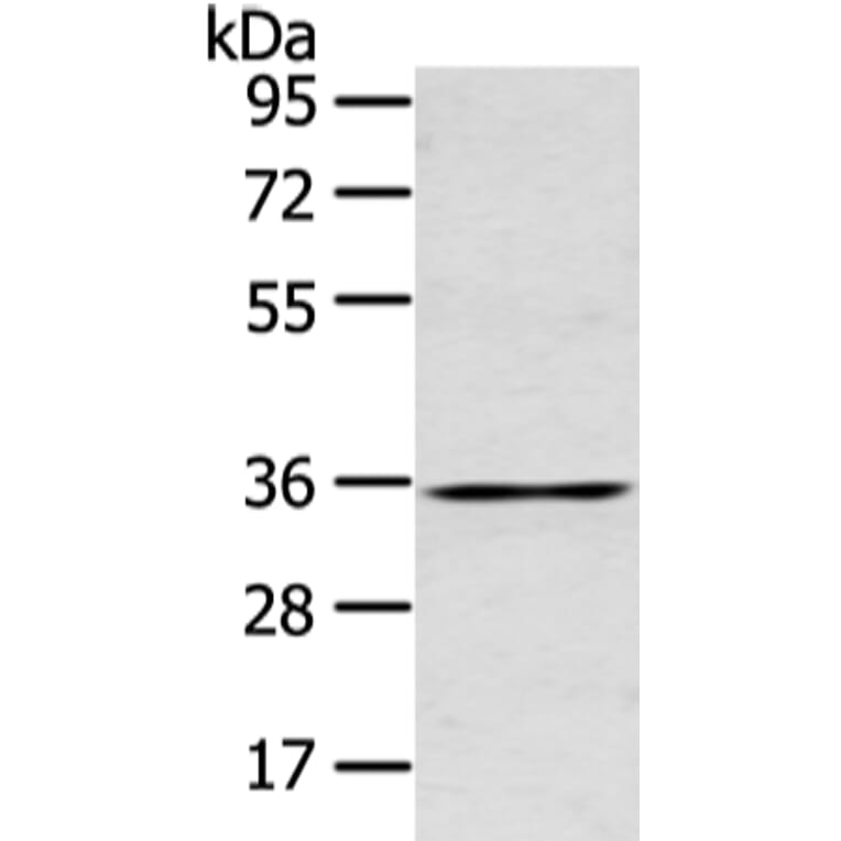 GJB5 Antibody from Signalway Antibody (43239) - Antibodies.com