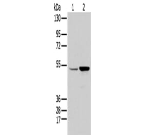 EGR2 Antibody from Signalway Antibody (43313) - Antibodies.com