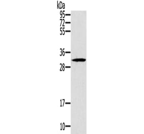 DKK1 Antibody from Signalway Antibody (43318) - Antibodies.com