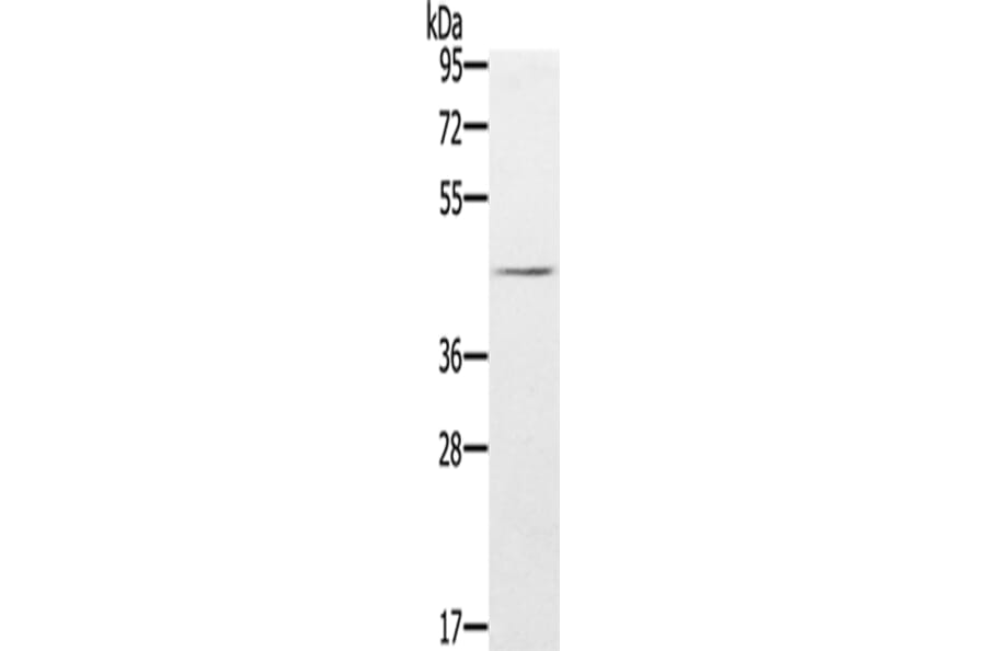 FLI1 Antibody from Signalway Antibody (43320) - Antibodies.com