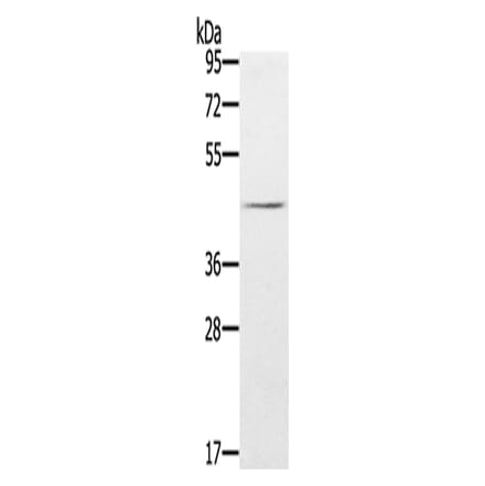 FLI1 Antibody from Signalway Antibody (43320) - Antibodies.com