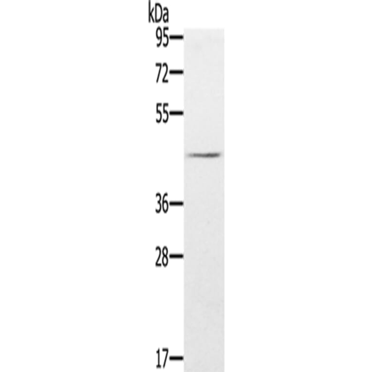 FLI1 Antibody from Signalway Antibody (43320) - Antibodies.com