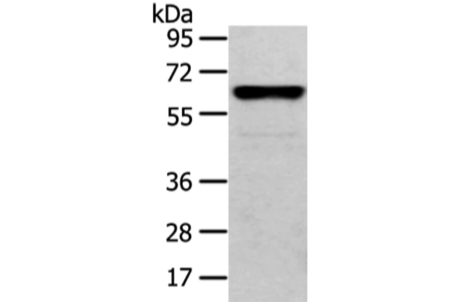 CLK2 Antibody from Signalway Antibody (43405) - Antibodies.com