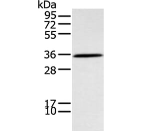 NEK7 Antibody from Signalway Antibody (43407) - Antibodies.com