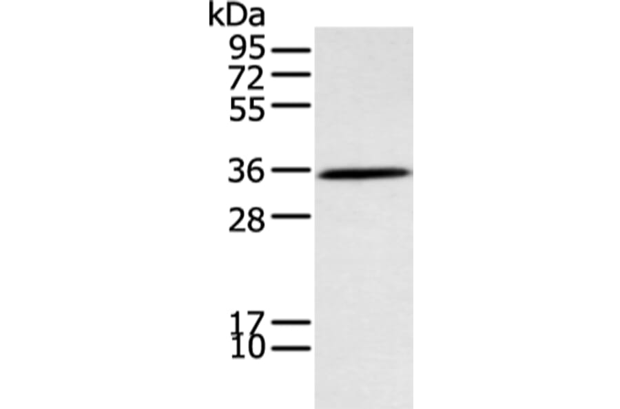 NEK7 Antibody from Signalway Antibody (43407) - Antibodies.com