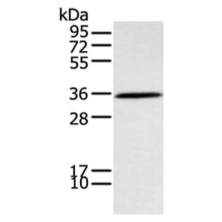 NEK7 Antibody from Signalway Antibody (43407) - Antibodies.com