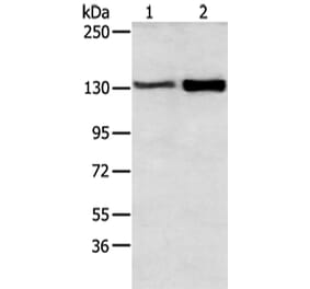 DSG3 Antibody from Signalway Antibody (43412) - Antibodies.com
