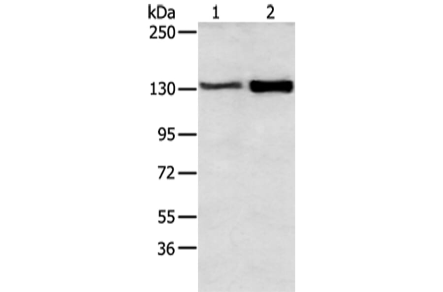 DSG3 Antibody from Signalway Antibody (43412) - Antibodies.com
