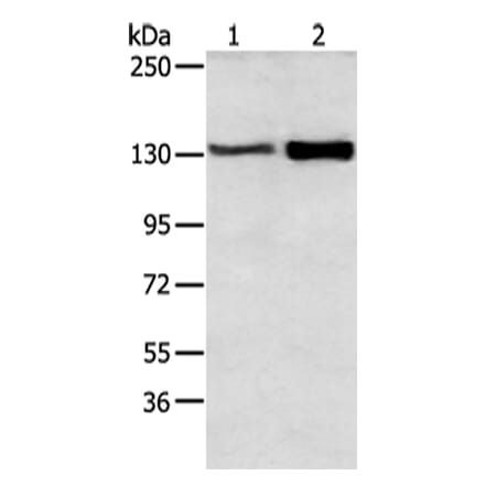 DSG3 Antibody from Signalway Antibody (43412) - Antibodies.com