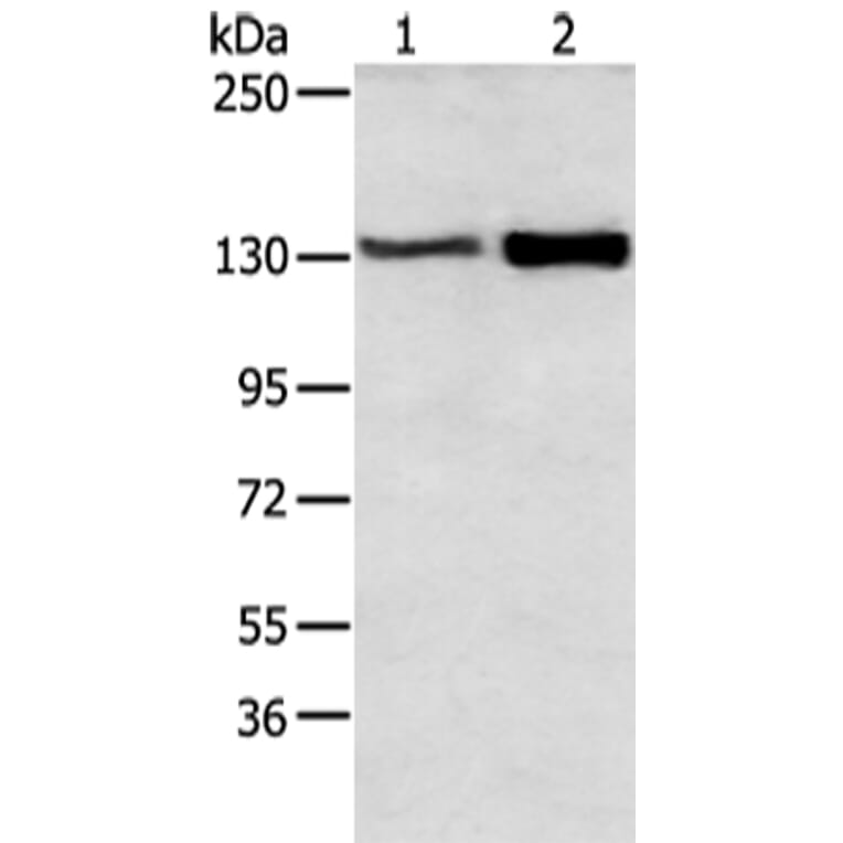 DSG3 Antibody from Signalway Antibody (43412) - Antibodies.com