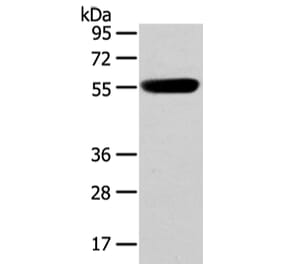 CBX4 Antibody from Signalway Antibody (43446) - Antibodies.com