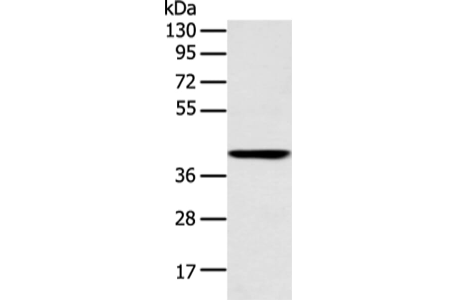 E2F1 Antibody from Signalway Antibody (43456) - Antibodies.com
