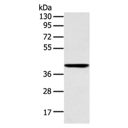 E2F1 Antibody from Signalway Antibody (43456) - Antibodies.com