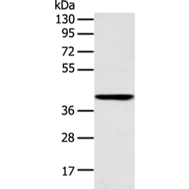 E2F1 Antibody from Signalway Antibody (43456) - Antibodies.com