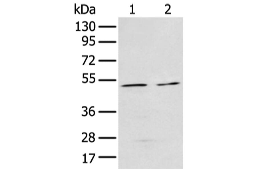 E2F3 Antibody from Signalway Antibody (43472) - Antibodies.com