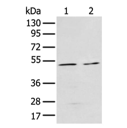 E2F3 Antibody from Signalway Antibody (43472) - Antibodies.com