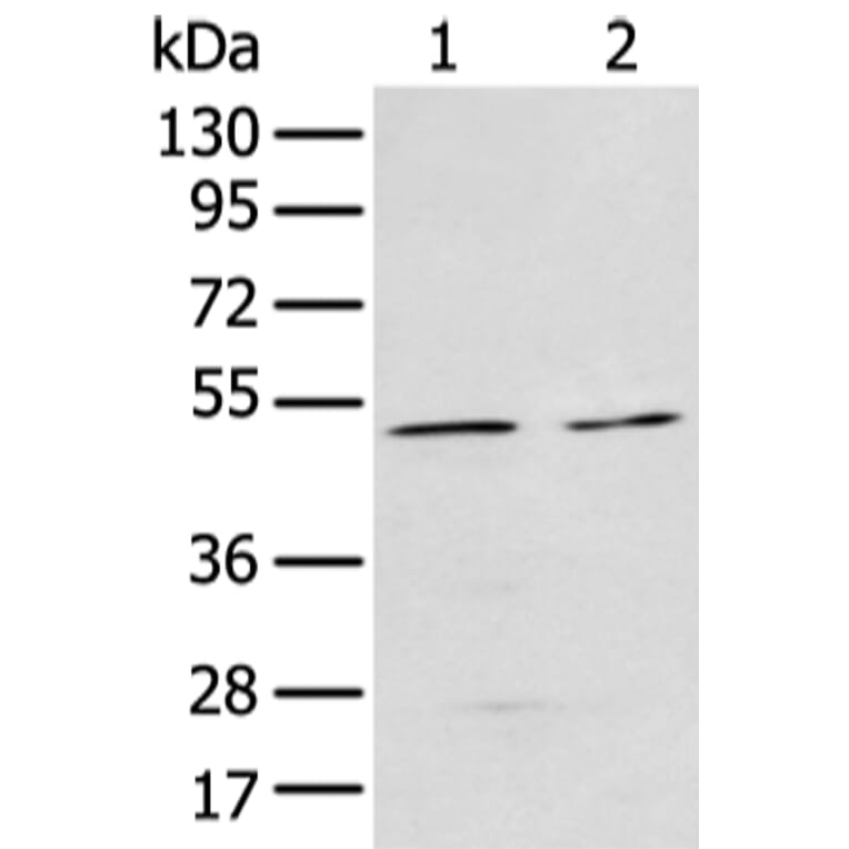 E2F3 Antibody from Signalway Antibody (43472) - Antibodies.com