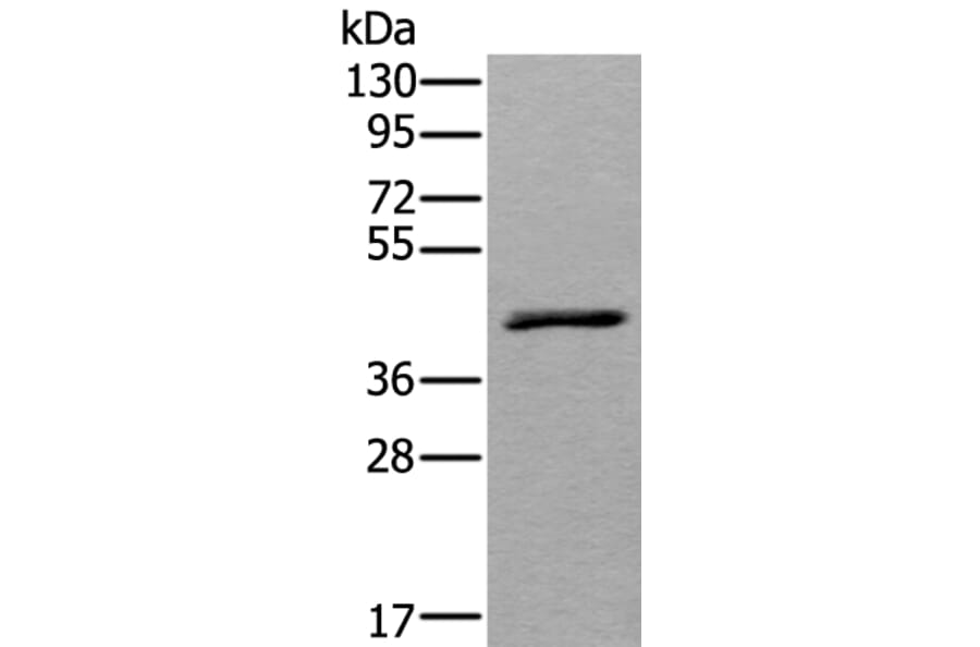WSB2 Antibody from Signalway Antibody (43543) - Antibodies.com
