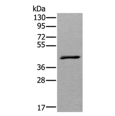 WSB2 Antibody from Signalway Antibody (43543) - Antibodies.com