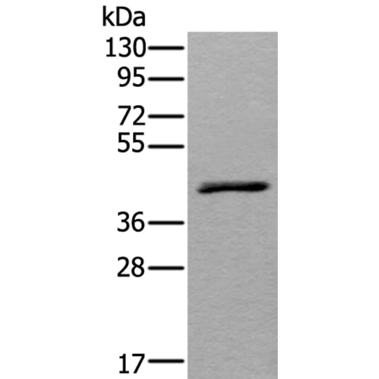 WSB2 Antibody from Signalway Antibody (43543) - Antibodies.com