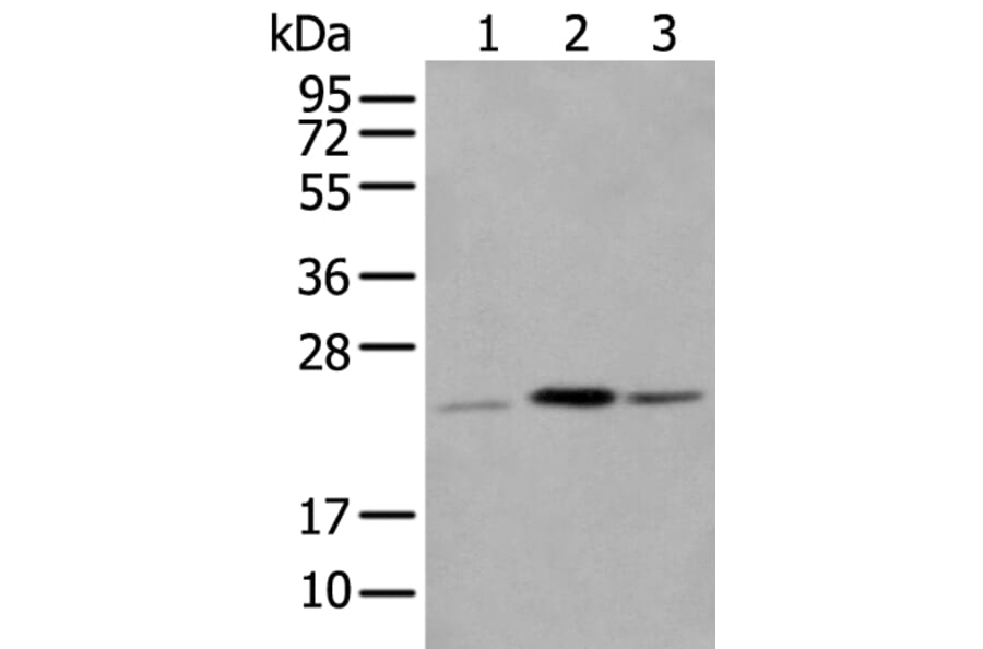 CBR4 Antibody from Signalway Antibody (43558) - Antibodies.com