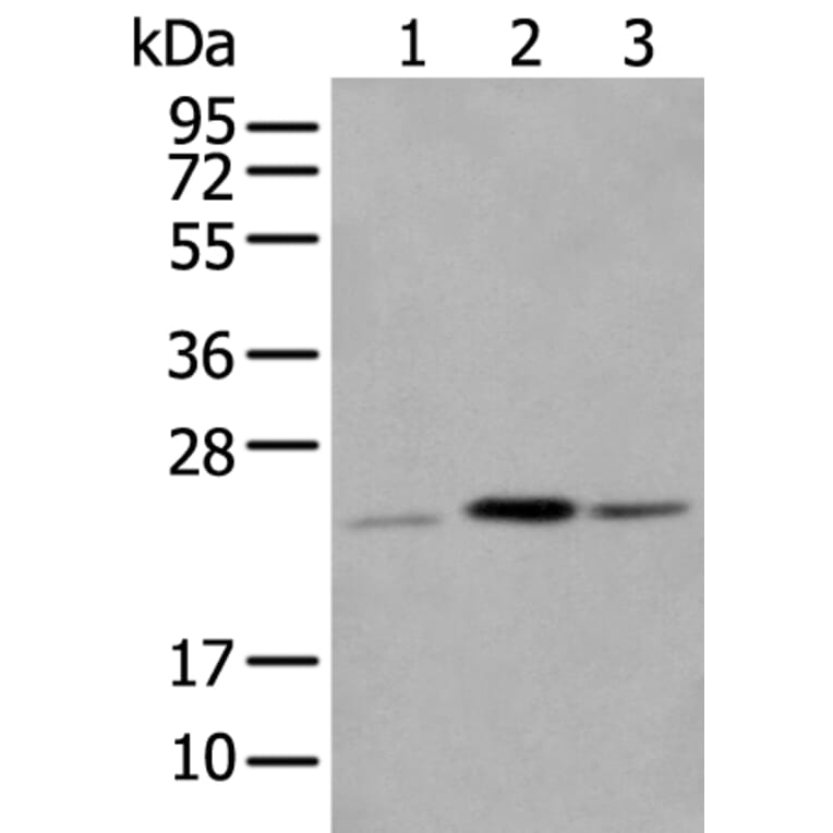 CBR4 Antibody from Signalway Antibody (43558) - Antibodies.com