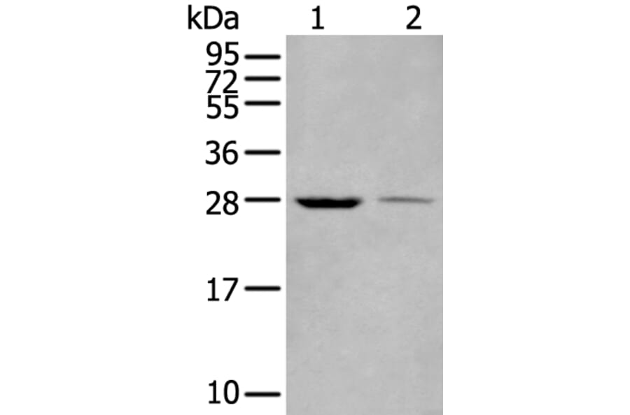 WBP1 Antibody from Signalway Antibody (43589) - Antibodies.com