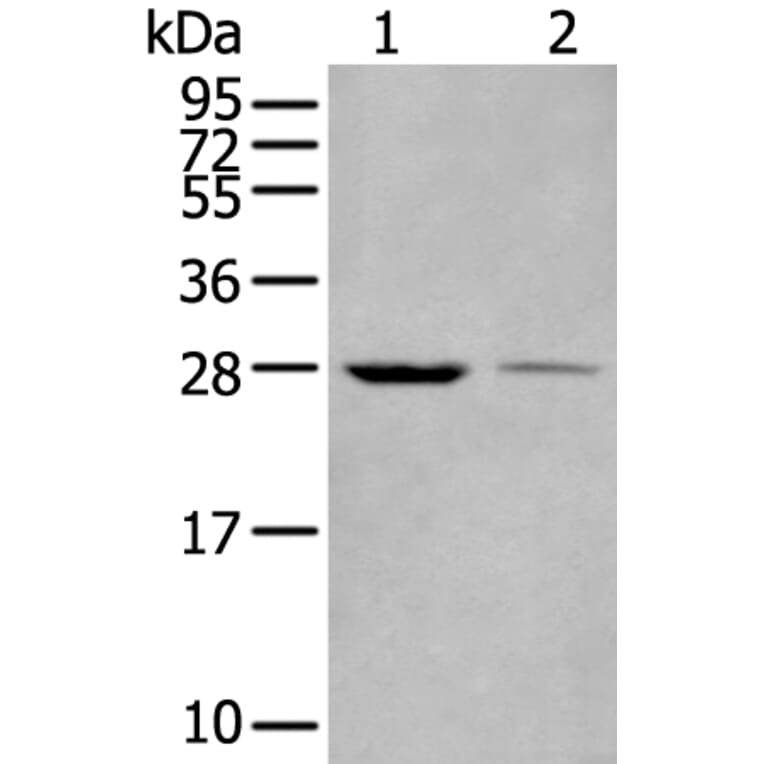 WBP1 Antibody from Signalway Antibody (43589) - Antibodies.com