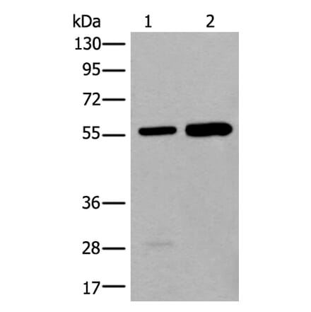 ATE1 Antibody from Signalway Antibody (43840) - Antibodies.com