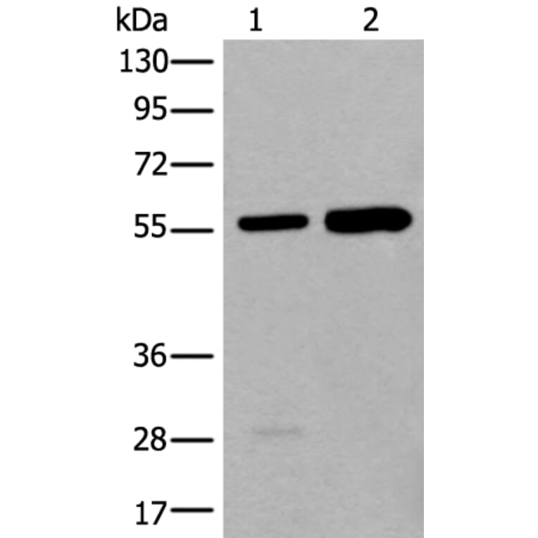 ATE1 Antibody from Signalway Antibody (43840) - Antibodies.com