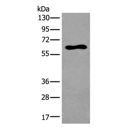 THRA Antibody from Signalway Antibody (43913) - Antibodies.com