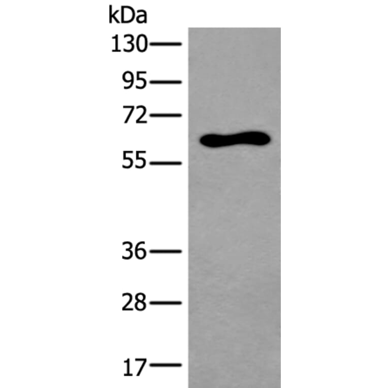 THRA Antibody from Signalway Antibody (43913) - Antibodies.com