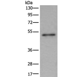 BMP5 Antibody from Signalway Antibody (43997) - Antibodies.com