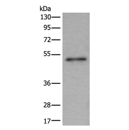 BMP5 Antibody from Signalway Antibody (43997) - Antibodies.com