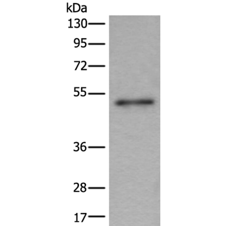 BMP5 Antibody from Signalway Antibody (43997) - Antibodies.com