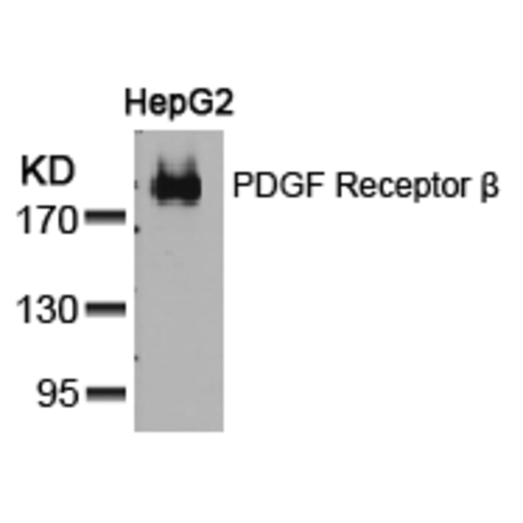 Western blot - PDGF Receptor b (Ab-751) Antibody from Signalway Antibody (21219) - Antibodies.com