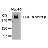 Western blot - PDGF Receptor b (Ab-751) Antibody from Signalway Antibody (21219) - Antibodies.com