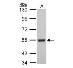 Retinoid X Receptor beta antibody from Signalway Antibody (22702) - Antibodies.com